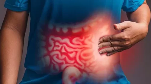 All the Digestive Abnormalities