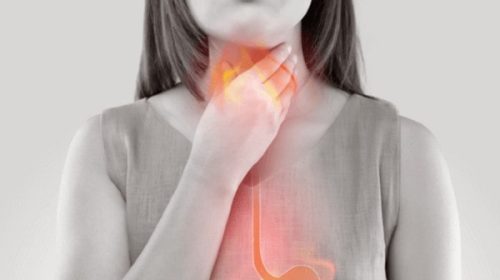 Gastroesophageal Reflux Disorders