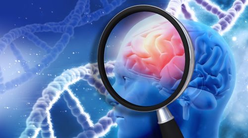 Migraine - Genetic disorder