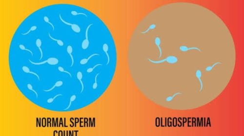 better oligospermia